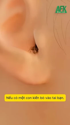 Chuyện gì xảy ra nếu một con kiến bò vào tai bạn?