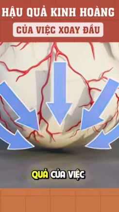 Hậu quả kinh hoàng của việc xoay đầu