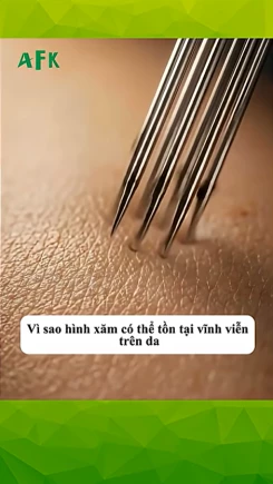 Lý do hình xăm không thể xóa